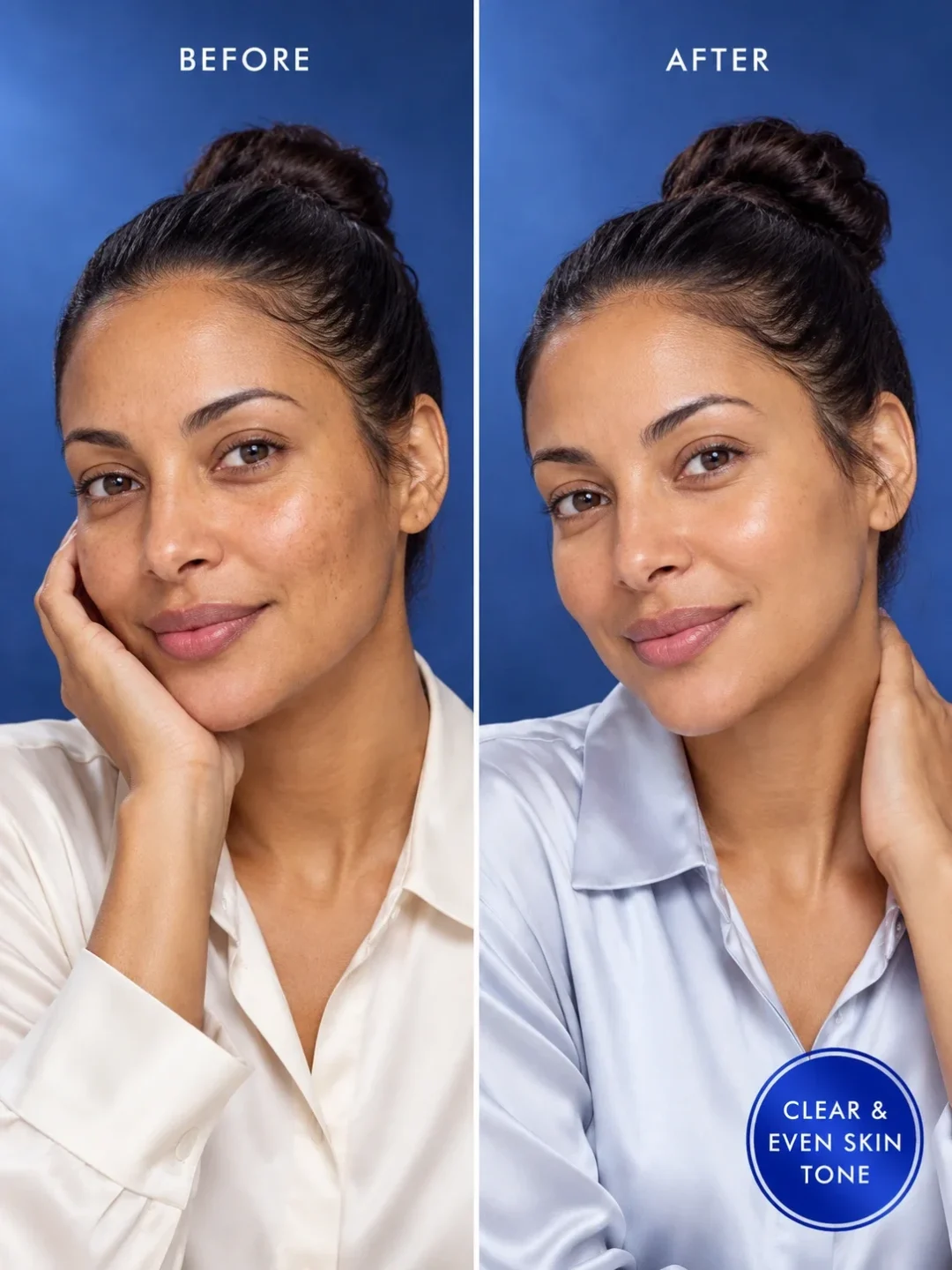 Nila soap before and after for dark spots, hyperpigmentation and more even-looking skin tone Nila soap before and after for dark spots, hyperpigmentation and more even-looking skin tone