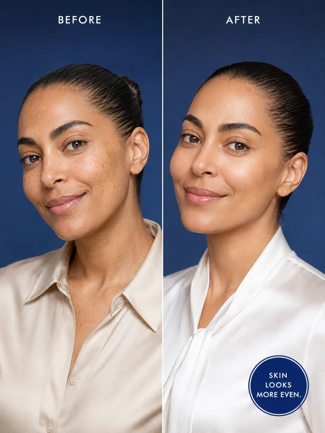 Before and after Nila cream results for dark spots and more even-looking skin tone