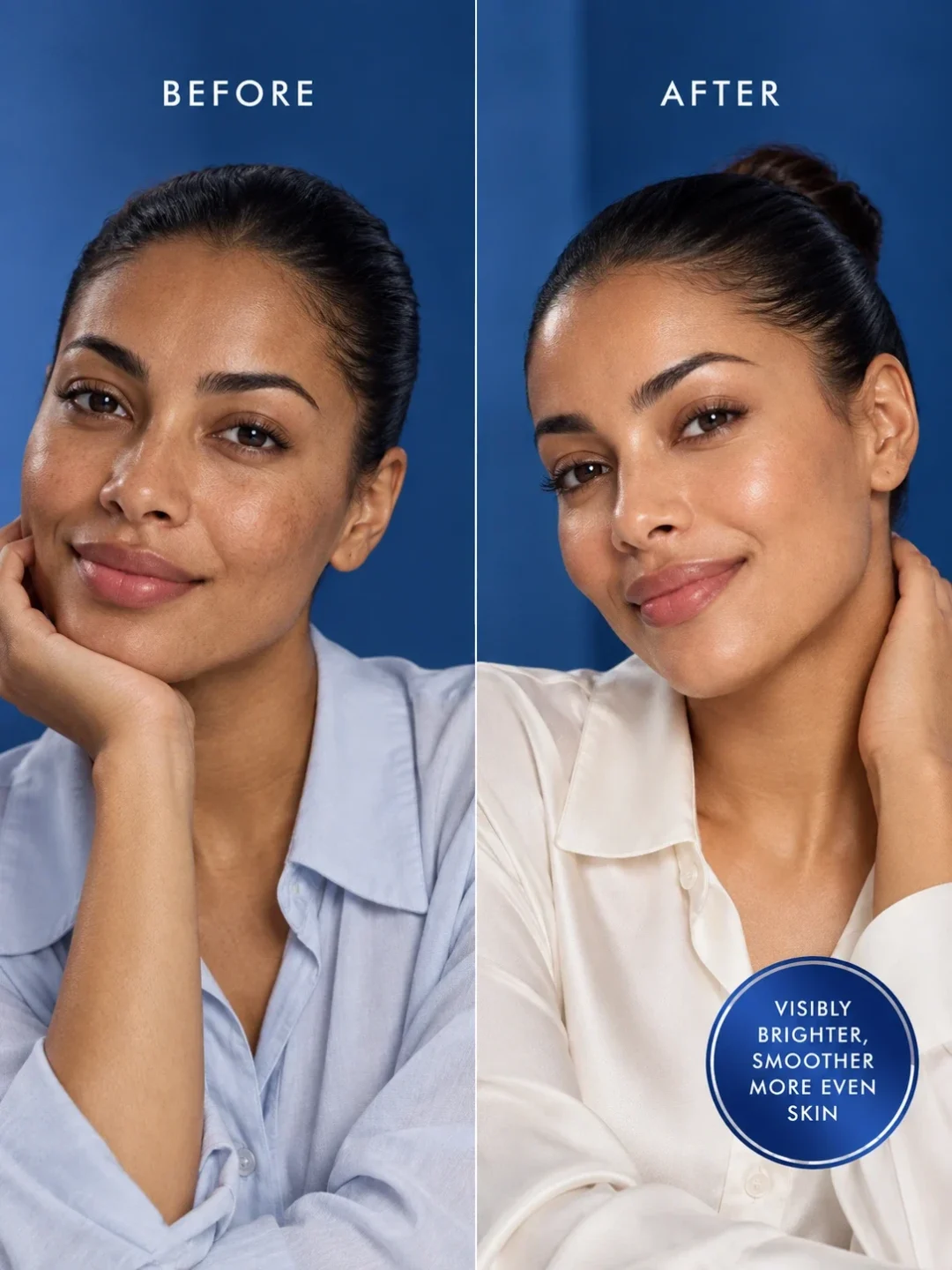 Nila scrub before and after for dark spots, uneven skin tone and smoother radiant-looking skin Nila scrub before and after for dark spots, uneven skin tone and smoother radiant-looking skin