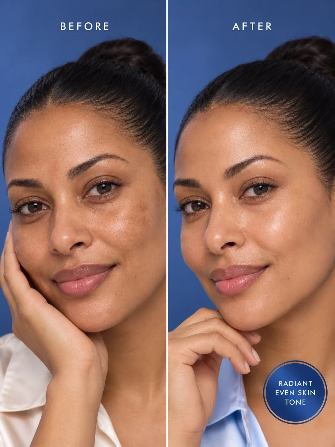 Nila Powder before and after for uneven skin tone, dark spots and naturally radiant clear skin