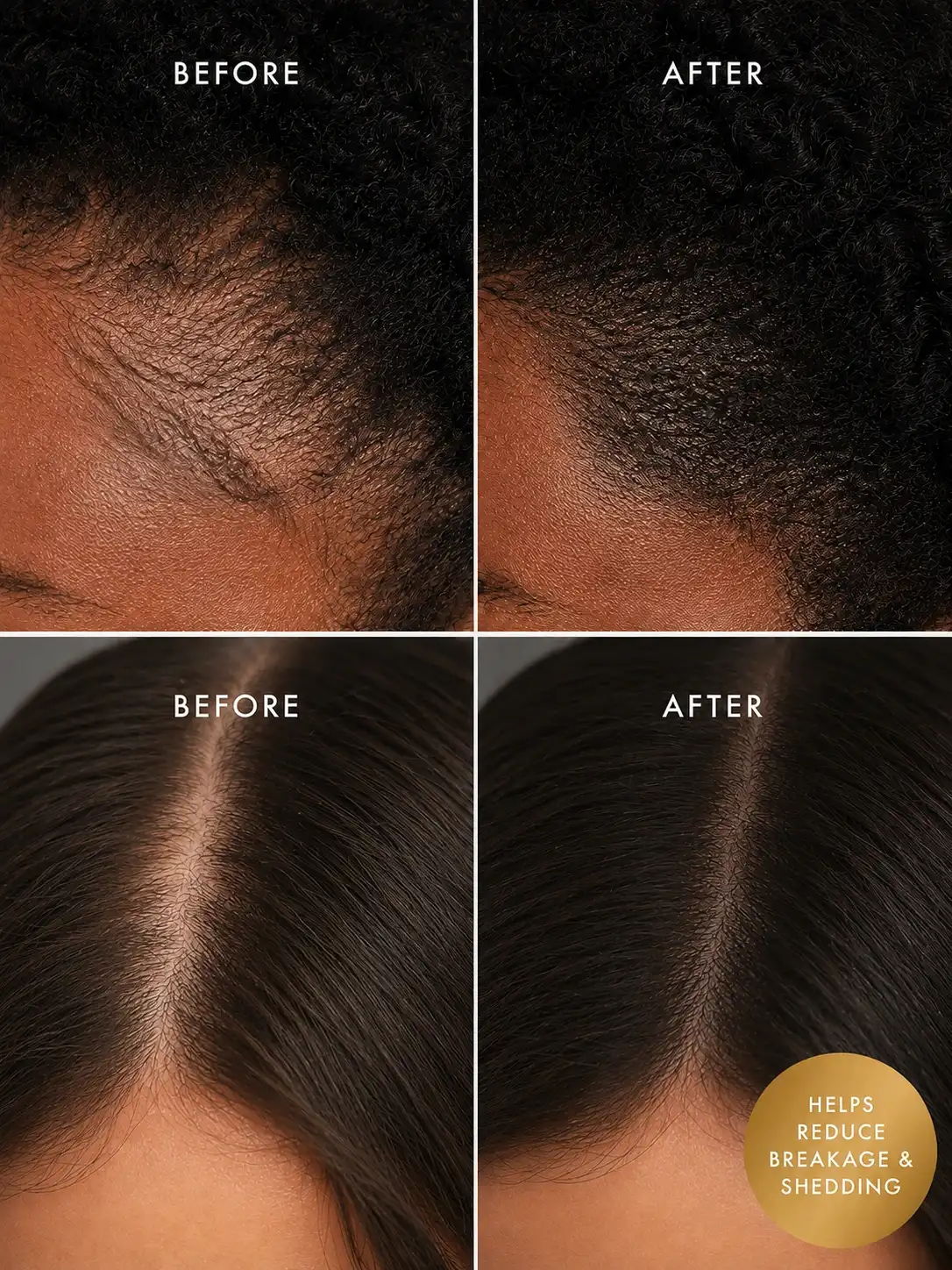 rosemary hair oil before and after for stronger fuller looking hair