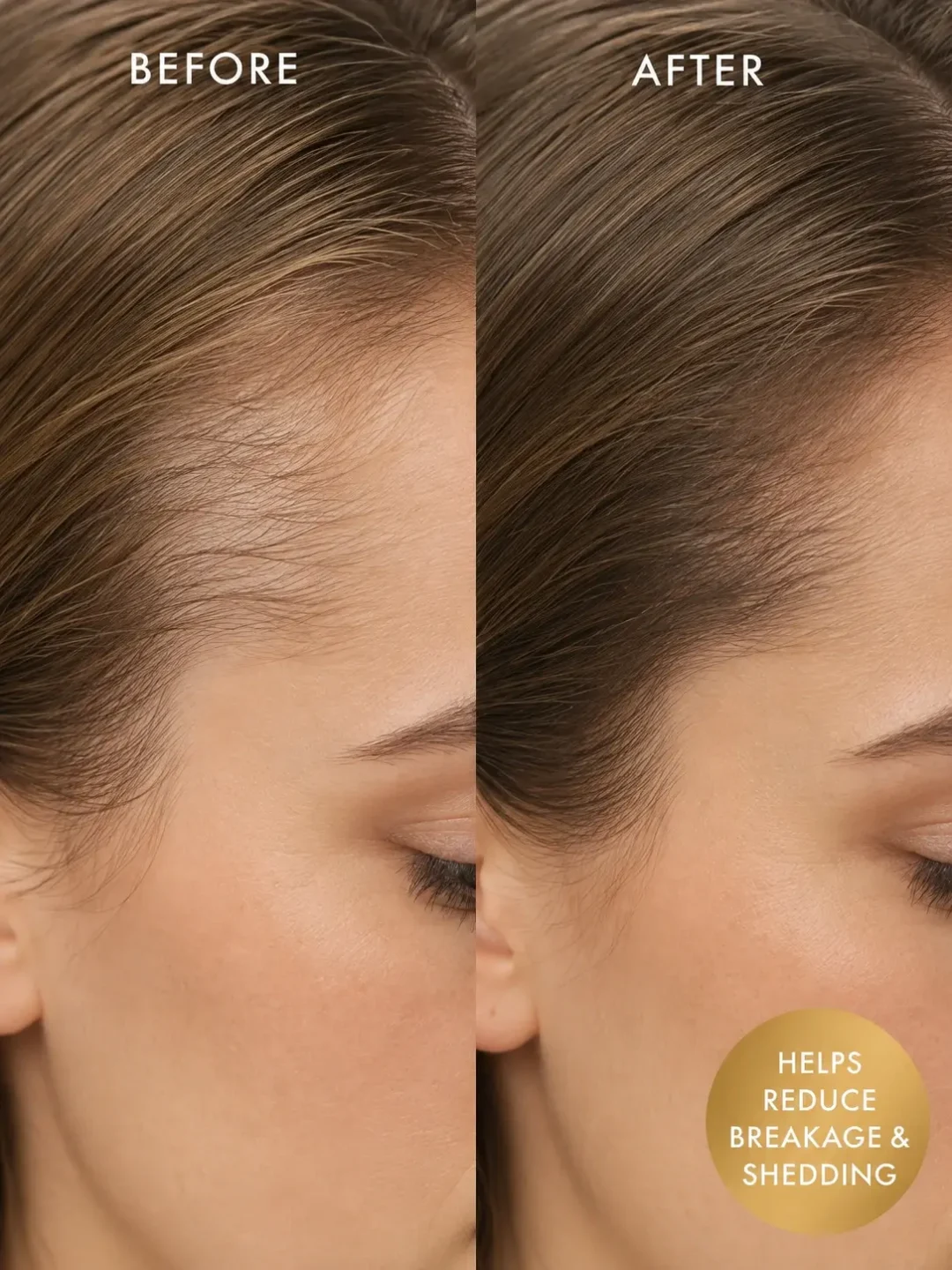 rosemary hair oil before and after for stronger fuller looking hair