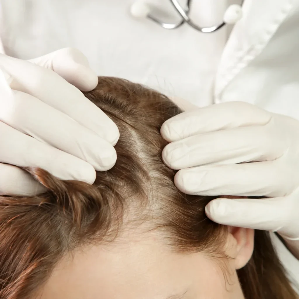 Rosemary Oil for Hair Growth - TASANO