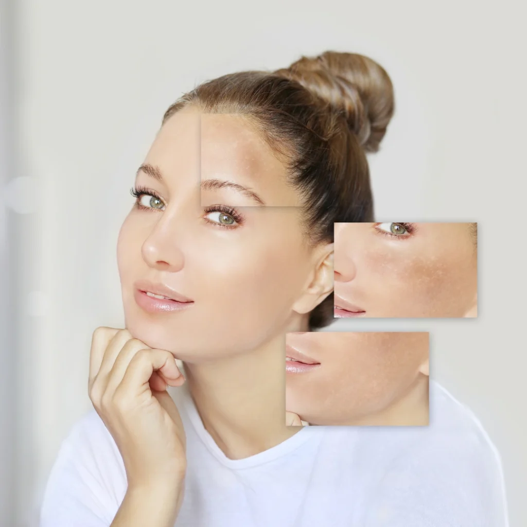 Best Moroccan Beauty Products for Dark Spots - TASANO