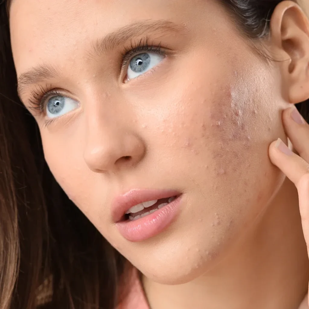 Prickly Pear Seed Oil vs Argan Oil - TASANO