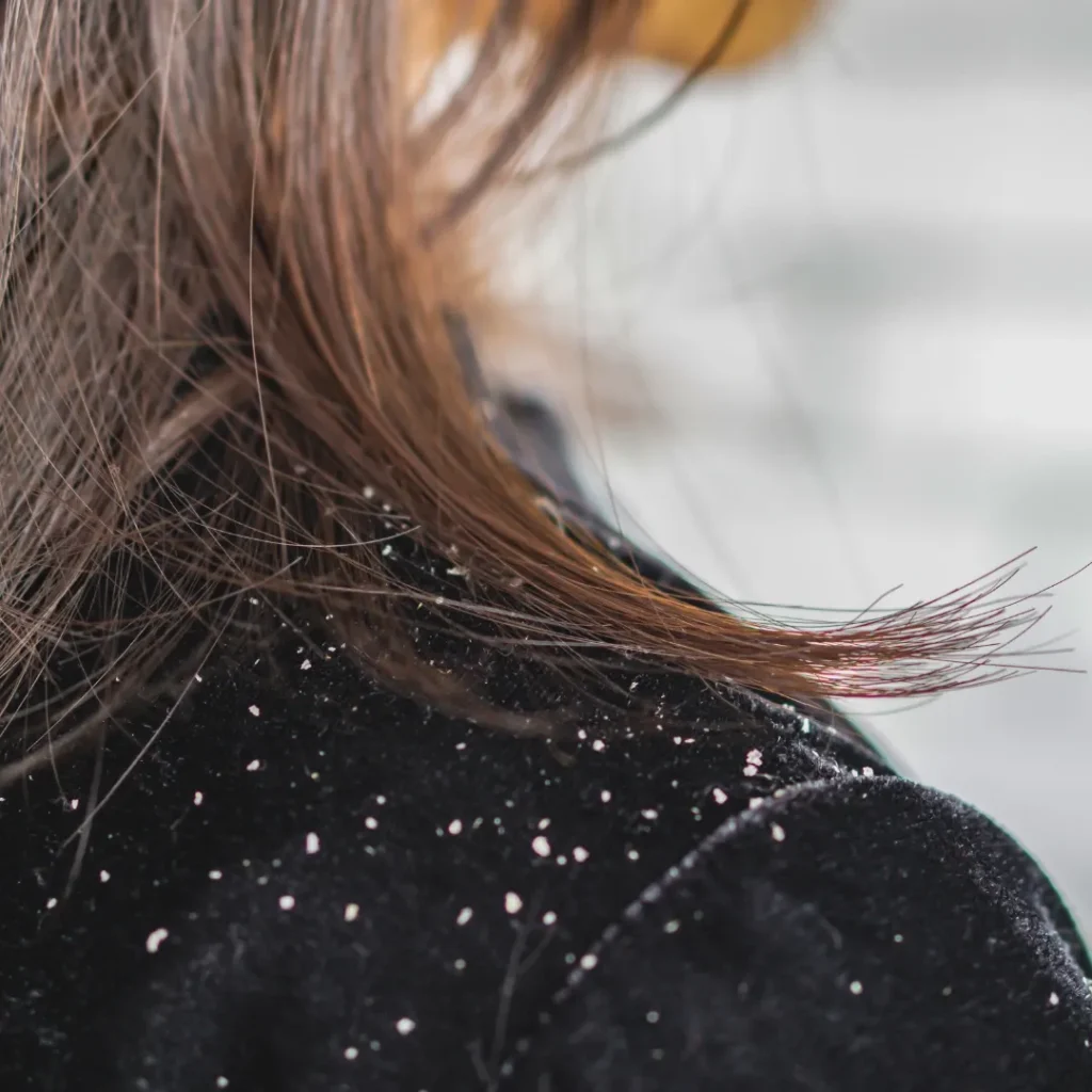 Argan Oil for Scalp - TASANO