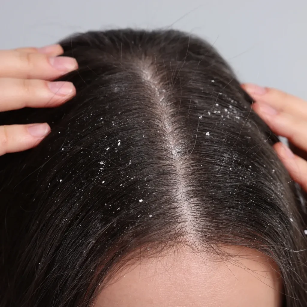 Argan Oil for Scalp - TASANO