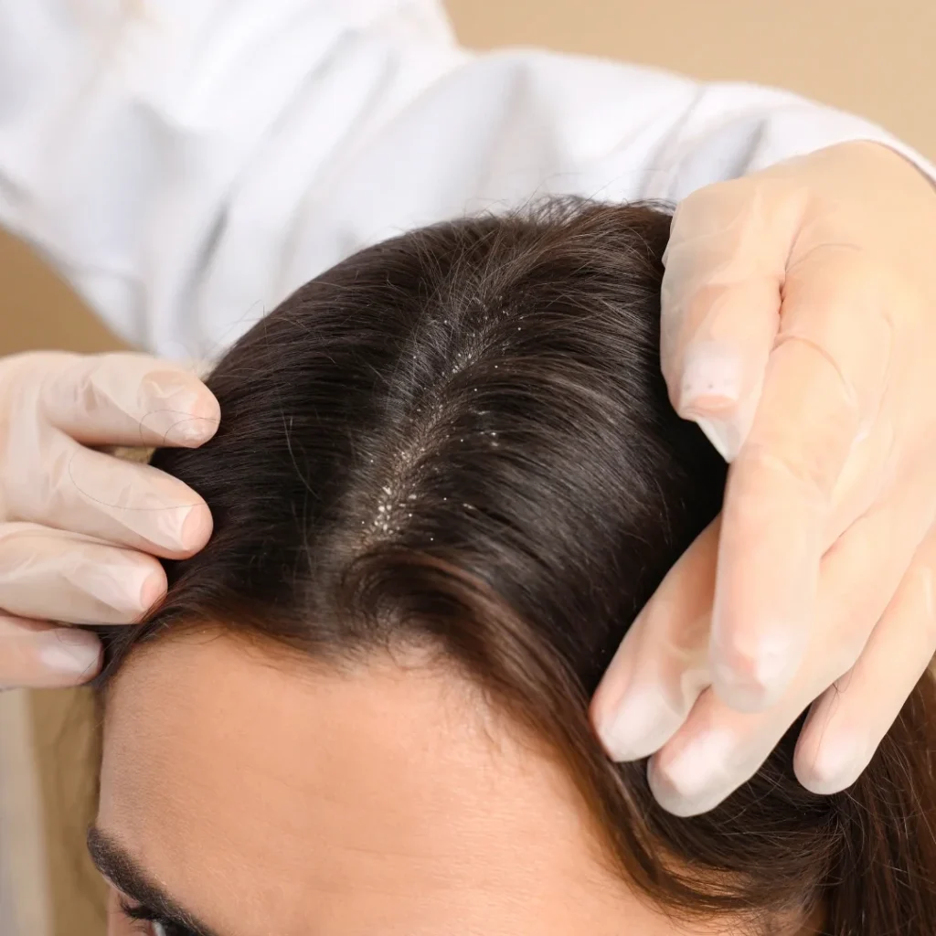 Argan Oil for Scalp - TASANO